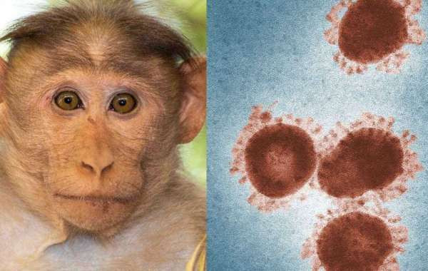 5 Female Porn Stars Infected With MonkeyPox. Outbreak?